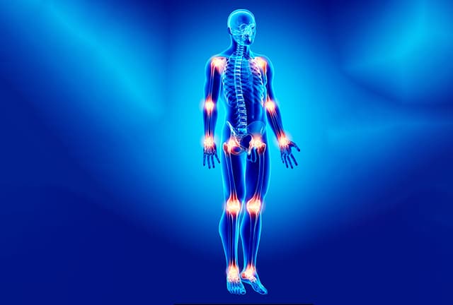 Illustration highlighting musculoskeletal pain points on the body