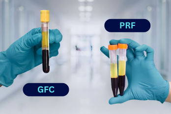 GFC vs PRF